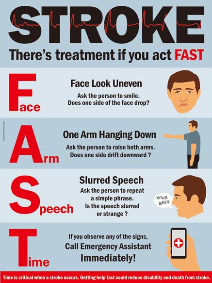 Act FAST for Stroke
