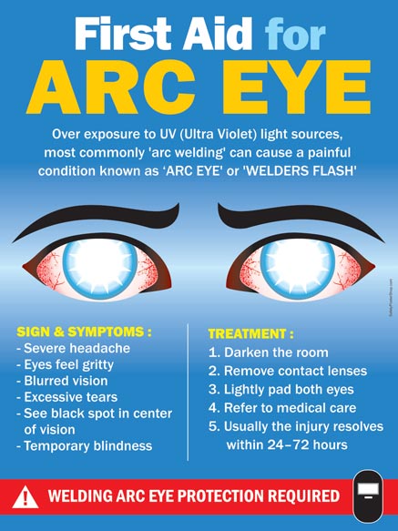 First Aid For Arc Eye Safety Poster Shop
