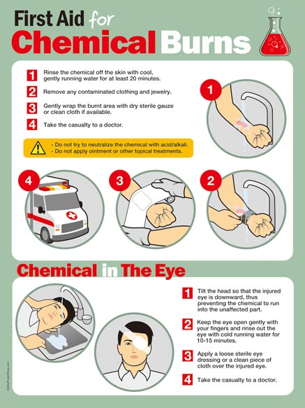 chemical burn first aid