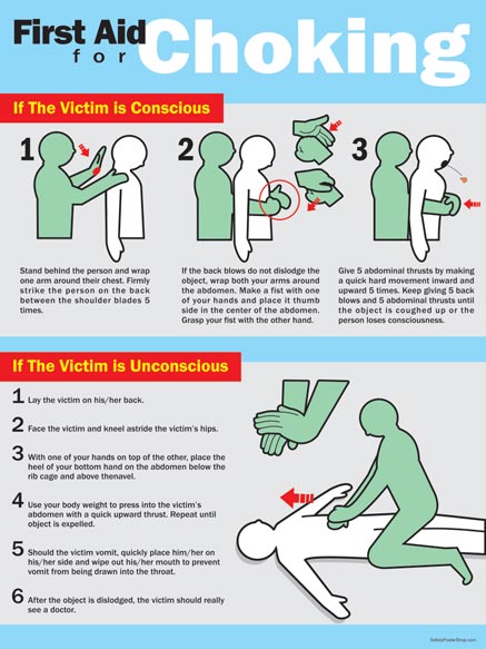 choking first aid presentation