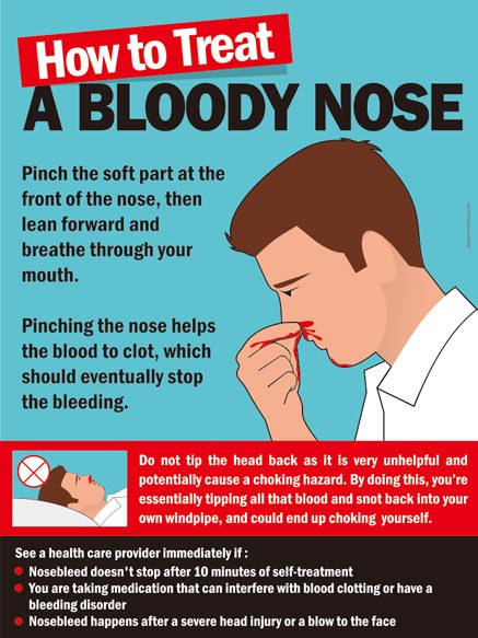 How to Treat a Bloody Nose
